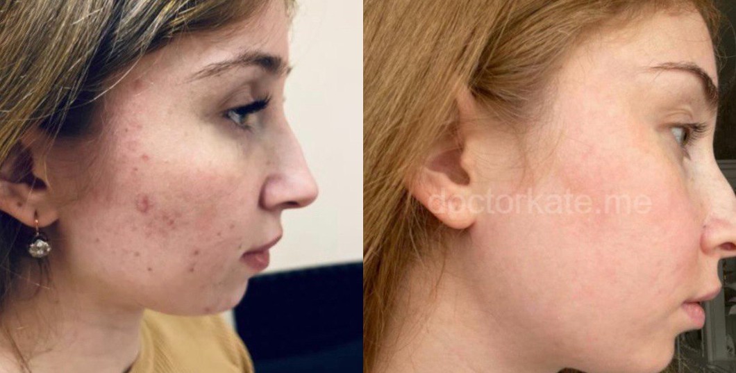 Моя работа 4