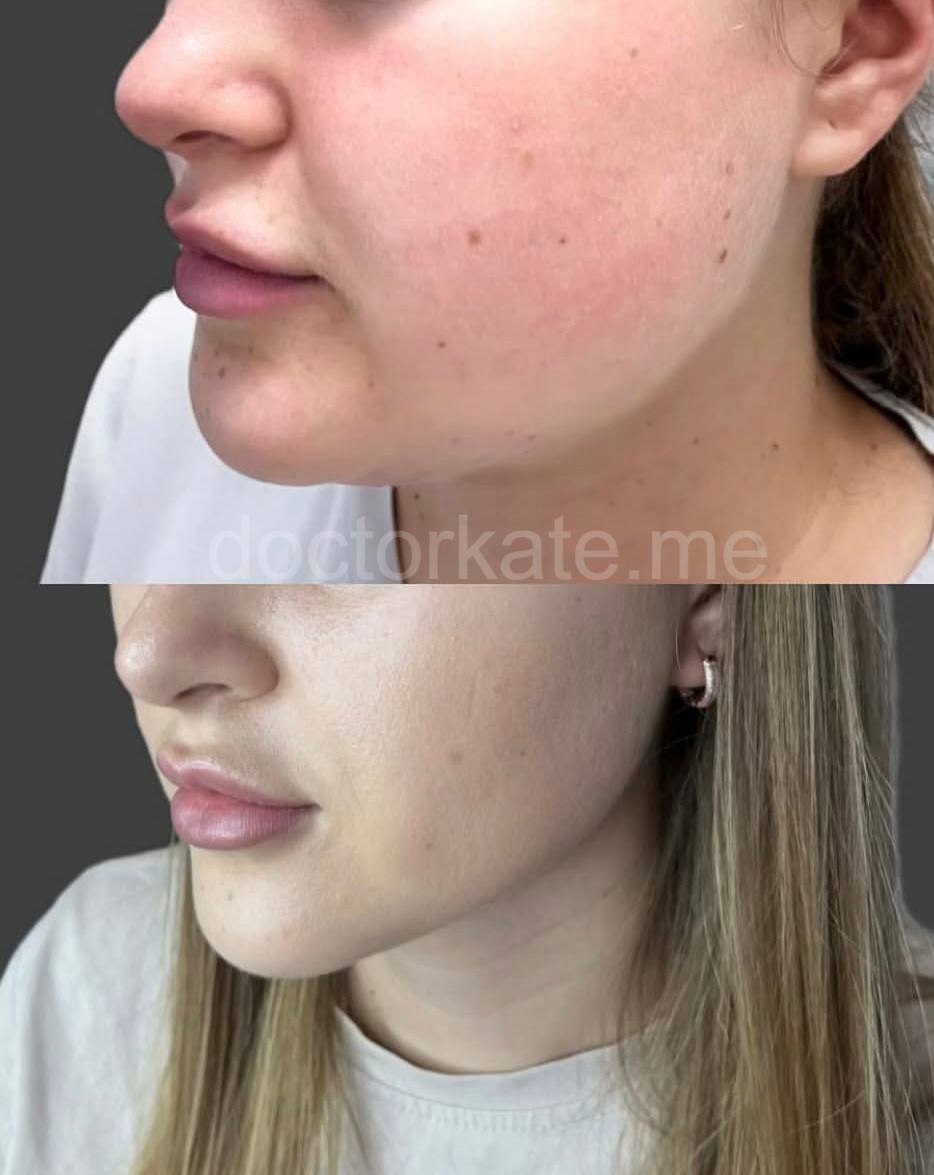 Моя работа 2