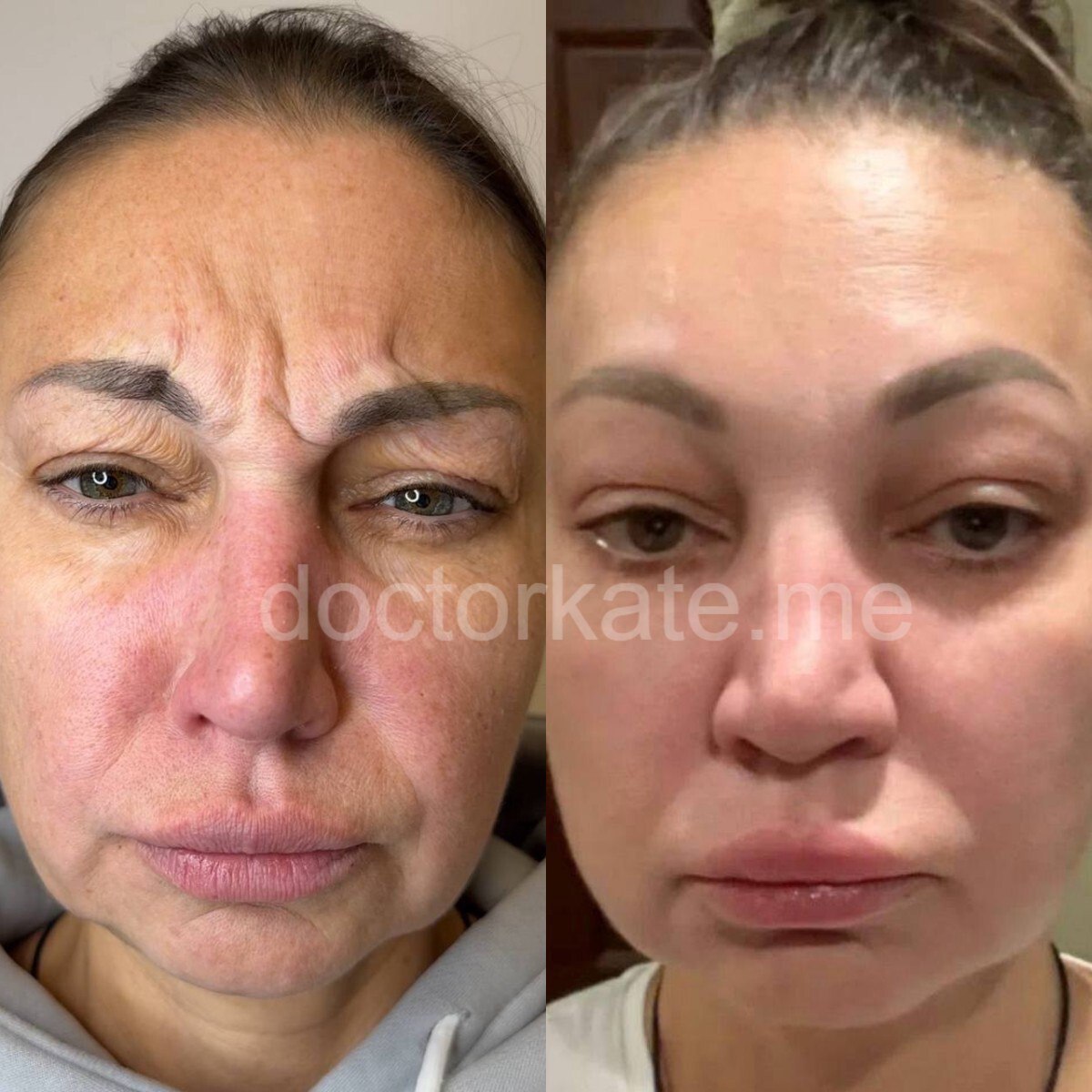 Моя работа 6