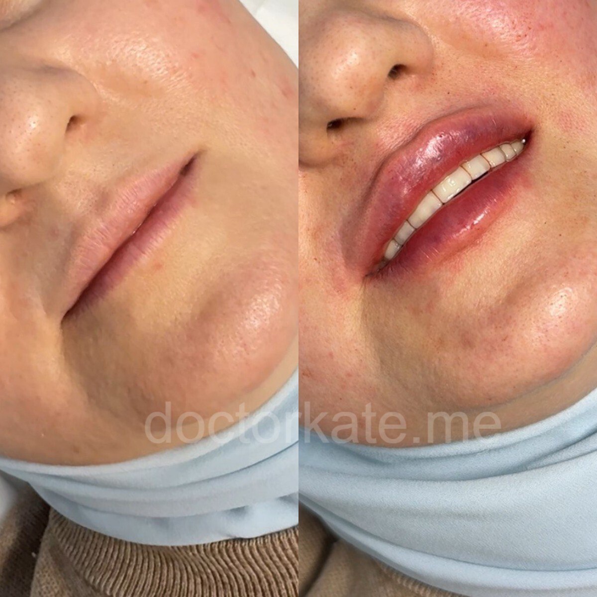 Моя работа 10